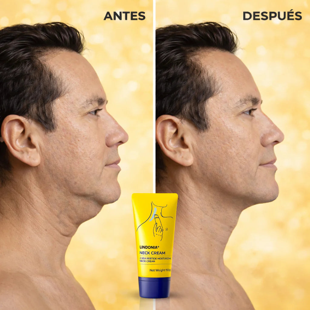Lindonia® ActiveLift™ Reafirmante Cuello